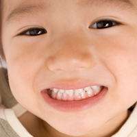 子供の歯の治療・小児歯科
